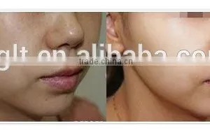 Merry Christmas Biggest Discount! Wholesale Skin Beauty Mesotherapy Injector Gun From Korea thumbnail-5