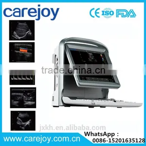 2016 NEW Ultrasound Scanner Color Doppler thumbnail-1
