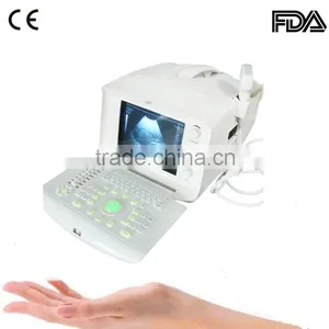 Low Cheap FDA CE Mark Portable Ultrasound Scanner With Convex Linear Transvaginal Rectal Probe Optional thumbnail-1
