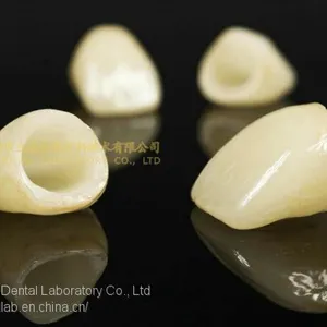 Dental Crown E.Max Ceramic, Porcelain Crown, Dental Veneers, Laboratoire Dentaire, Dentallabor, Laboratorio Dental, Dental Laboratory, Shenzhen LJ Dental Lab China thumbnail-2