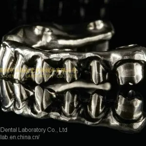 Full-arch Implant Bridge Prosthesis, Implant Denture Framework, Implant Prosthesis, Laboratoire Dentaire, Dentallabor, Laboratorio Dental, Dental Laboratory, Shenzhen LJ Dental Lab China thumbnail-2