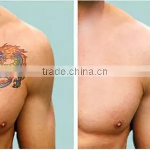 Wholesale q Switch nd Yag Laser Cost Device for Skin Care Medical Equipment thumbnail-6