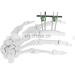 Guaranteed Quality Hoffmann Finger & Palm External Fixator Orthopedic Surgical Instrument thumbnail-1