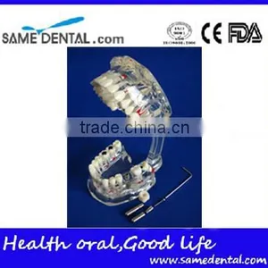 Dental Adult Pathological Dentition Model DEA-48 Teeth Model Teaching Demonstration thumbnail-3