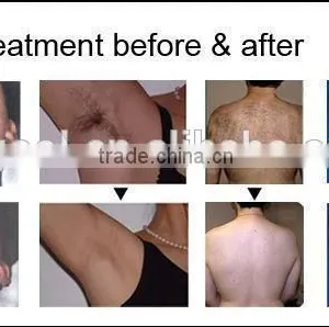 Home Use Body Hair Removal Body&Facial Laser Device thumbnail-5