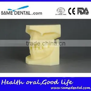 Malocclusion Classification Demonstration Model 2 thumbnail-3