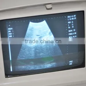 2016 CE Approved Digital Portable Style Ultrasound Machine/Scanner With Cheap Price thumbnail-2