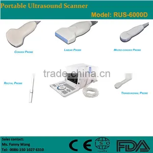 Digital Portable Ultrasound Scanner thumbnail-2