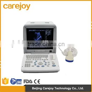 Factory Price!CE Approved Notebook B-Mode Ultrasound Scanner With 3.5Mhz Multi-frequency Convex Probe RUS-9000B thumbnail-1