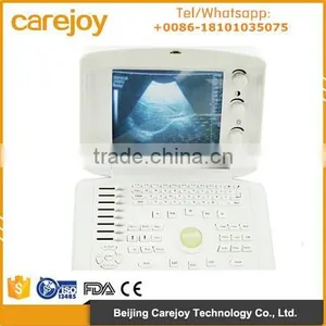 CE Approved Digital Portable Ultrasound Scanner With Multi Frequency Probe Machine thumbnail-1