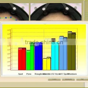 Professional Face Skin Test Machine !!!High Quality Skin Analyzer Visia Skin Analysis Machine thumbnail-5