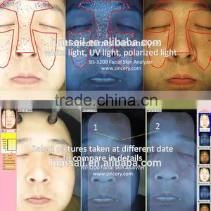 Portable Facial Skin Scanner Analyzer 3D Facial Skin Analysis thumbnail-5