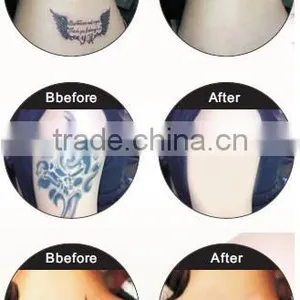 1-10Hz Powerful Big Movable Screen Professional Freckles Removal Machine Active Laser Tattoo Removal Q Switch Laser Tattoo Removal thumbnail-6