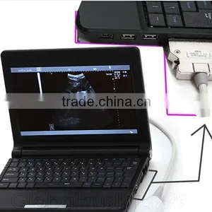 B Scan Laptop Ultrasound Scanner RUS-9000F Optional Convex Endocavity Trans Vaginal Micro Convex Linear Rectal Probe thumbnail-1