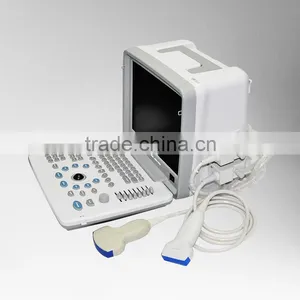Factory Price Hospital Clinics Equipment Ultrasonic Machine Portable Ultrasound Scanner With Multi Frequency Probe thumbnail-5