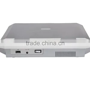 Laptop Ultrasound Scanner Diagnosis of Liver, Gallbladder, Kidney, Spleen 3018 thumbnail-6