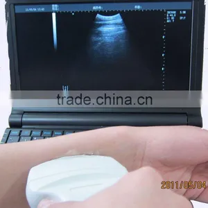 Factory Price! CE Approved Cheap Ultrasound Scanner With 3.5Mhz Convex Probe thumbnail-2