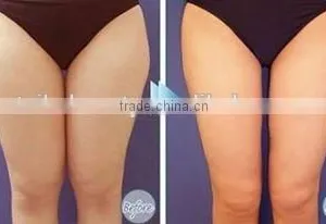 Reduce Cellulite Cryolipolysis Fat Freeze Skin Tightening Slimming Machine/cryolipolysis Slim Freeze Belt Machine thumbnail-6