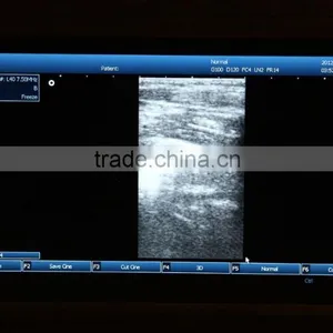 Cheapest Large Screen Good Image Laptop Ultrasound Scanner Machine With Probe-3&D External Workstation-RUS-9000E2 thumbnail-3