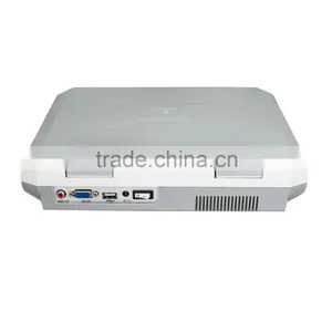 CE Laptop Ultrasound Machine With Multi Frequency Probe Ultrasonic Diagnostic System RUS-9000F2 thumbnail-4