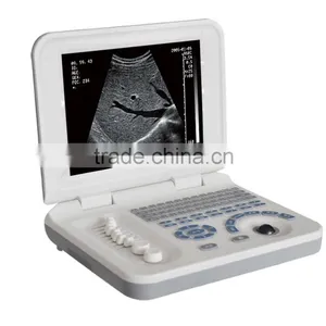 Ultrasound Equipments & Laptop Ultrasonic Machine 3018 thumbnail-3