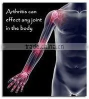 (Arthritis / Arthrophlogosis ) Pain Relieve Low Level Laser Therapeutic Apparantus thumbnail-1