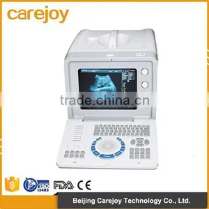 Portable Ultrasound Scanner Ultrasonic Diagnostic Machine System RUS-6000D With 3.5MHz Convex Probe Factory thumbnail-1