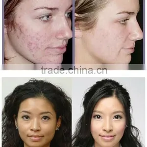 China Wholesale China Pure Oxygen Facial Equipment thumbnail-5