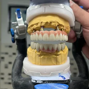 Myy International Dental Lab All on 4/6 Dental Manufacturer thumbnail-2