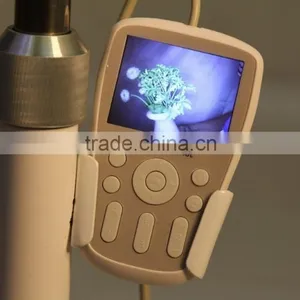 FY-9100A Excellent Portable Type Digital Electronic Colposcope thumbnail-2