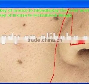 Portable Dialysis Machine/facial Skin Analyzer Machine Skin Scan/skin Analyser for Face thumbnail-6