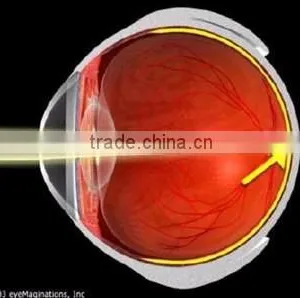 MCT Technology for Eyes Contact Lenses With Power From China thumbnail-1