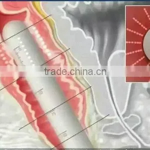 Multi-polar RF 2016 RF Tube Bags Under The Eyes Removal Hifu Machine Woman Vigina Tightening thumbnail-6