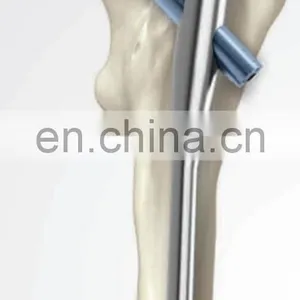 Orthopedic Trauma Implants PFNA thumbnail-6