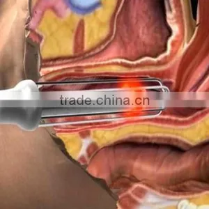 Good Result No Pain Fractional 40w Co2 Laser Vaginal Tightening Machine 1ms-5000ms thumbnail-6