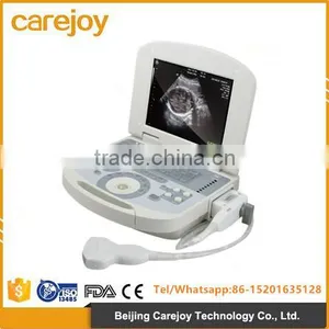 2017 Full Digital Portable Ultrasound Scanner ForAbdomen, Cardiac, Gynecology, Obstetrics Use thumbnail-1