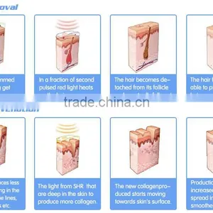 Manufacture Supply Permanent Hair Removal Elight Ipl/shr Hair Removal Machine thumbnail-3