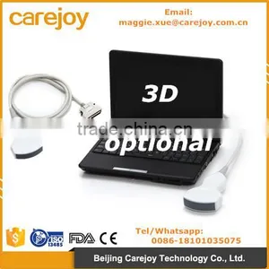 CE Certified Laptop Ultrasound Machine Ultrasonic Diagnostic System RUS-9000F With Convex Probe 3D Software Optional thumbnail-1
