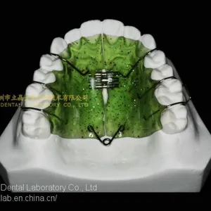 Space Expanders, Nance Appliance, Helix Appliance, Pendulum Appliance, ﻿﻿﻿﻿Porter Appliance, Fixed Lingual Expander, Sagittal Screw Appliance, Hyrax Rapid Palatal Expander, Orthodontic Retainers, Dental Orthodontic Appliance, Laboratoire Dentaire, Dentall thumbnail-1