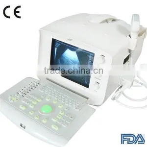 Carejoy FDA CE Mark Portable Ultrasound Scanner With Convex Linear Probe Diagnostic Pregnancy thumbnail-1
