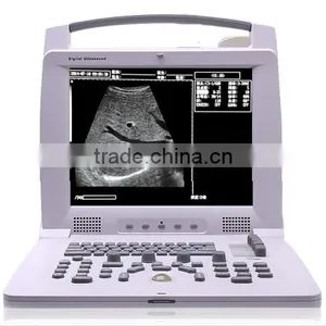 OB/GYN CE FDA Compact Multi-purpose Portable Doppler Ultrasound Scan thumbnail-4