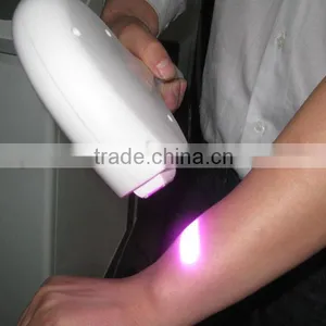 Men Hairline Pigmented Hair Dermi ICE Soprano Laser Hair Removal Machine/SHR 0-150J/cm2 Hair Removal 808nm Diode Laser/Lumenis Lightsheer Diode Laser Hair Removal Face thumbnail-2