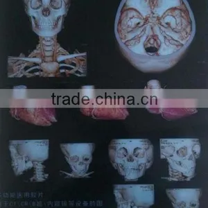 MQ Brand Good Quality Multi-function Medical pa Film thumbnail-3
