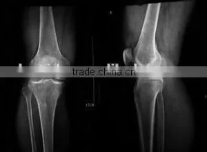 Dry Medical Thermal Dry Film KX410 X-ray Film Dry Film thumbnail-4