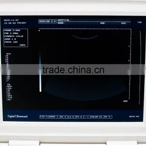 Ultrasonic, Optical, Electronic Equipments Laptop Portable B pc Based Ultrasound Scanner thumbnail-6