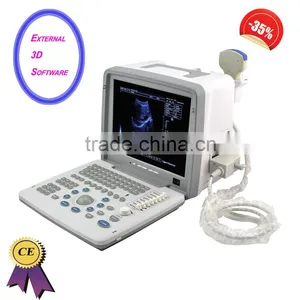 Factory Price!CE Approved Notebook B-Mode Ultrasound Scanner With 5.0Mhz Multi-frequency Micro-convex Probe RUS-9000B thumbnail-1