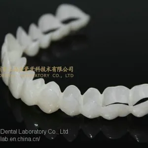 CAD/CAM PMMA Resin Clip on Veneers, Snap-on-veneers, Smile Veneers, Laboratoire Dentaire, Dentallabor, Laboratorio Dental, Dental Laboratory, Shenzhen LJ Dental Lab China thumbnail-5