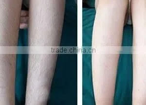 12x12mm IPL Diode Laser Hair Removal Bode Machine Price/IPL Skin Rejuvenation Machine Home thumbnail-6