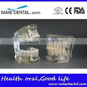 Teaching Using Transparent Deciduous Teeth Development Model 1 thumbnail-1
