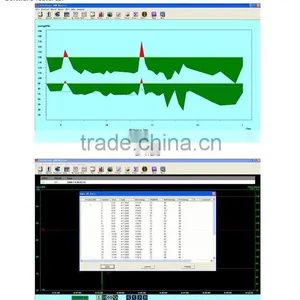 Specialized Digital ABPM+SpO2 Ambulatory Blood Pressure Monitor+24 Hours SpO2 Ambulatory Monitoring With PC Software Cuff thumbnail-3